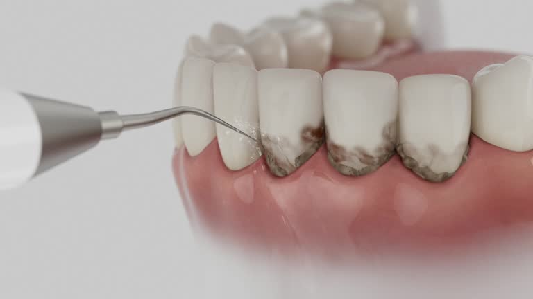 Reliable Dental contractor in Willits, CA by Smile Center Dentistry